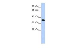 LHX3 Rabbit anti-Human, Polyclonal, Novus Biologicals 0.1 mL | Buy Online | Novus Biologicals | Fisher Scientific